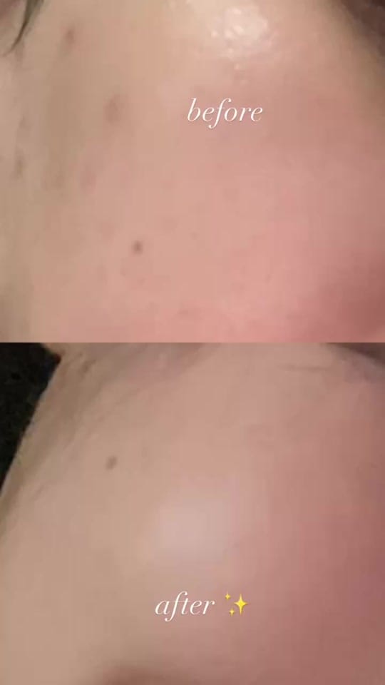 Post 1 by Leonybeauty on TikTok (video)
