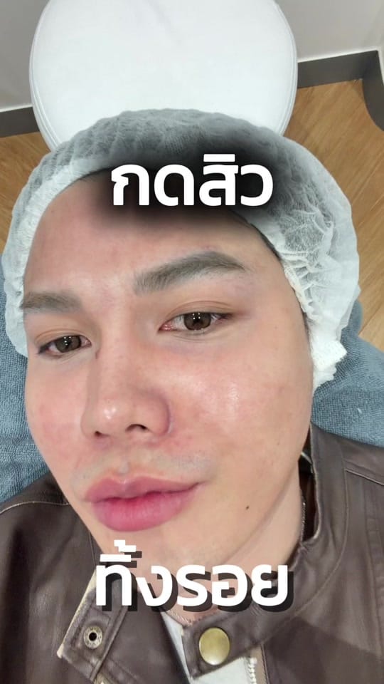 Post 1 by นายเฉลิม on TikTok (video)