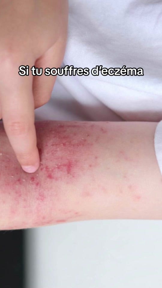 Post 10 by INASKIN - Ta ref en skincare🍉 on TikTok (video)