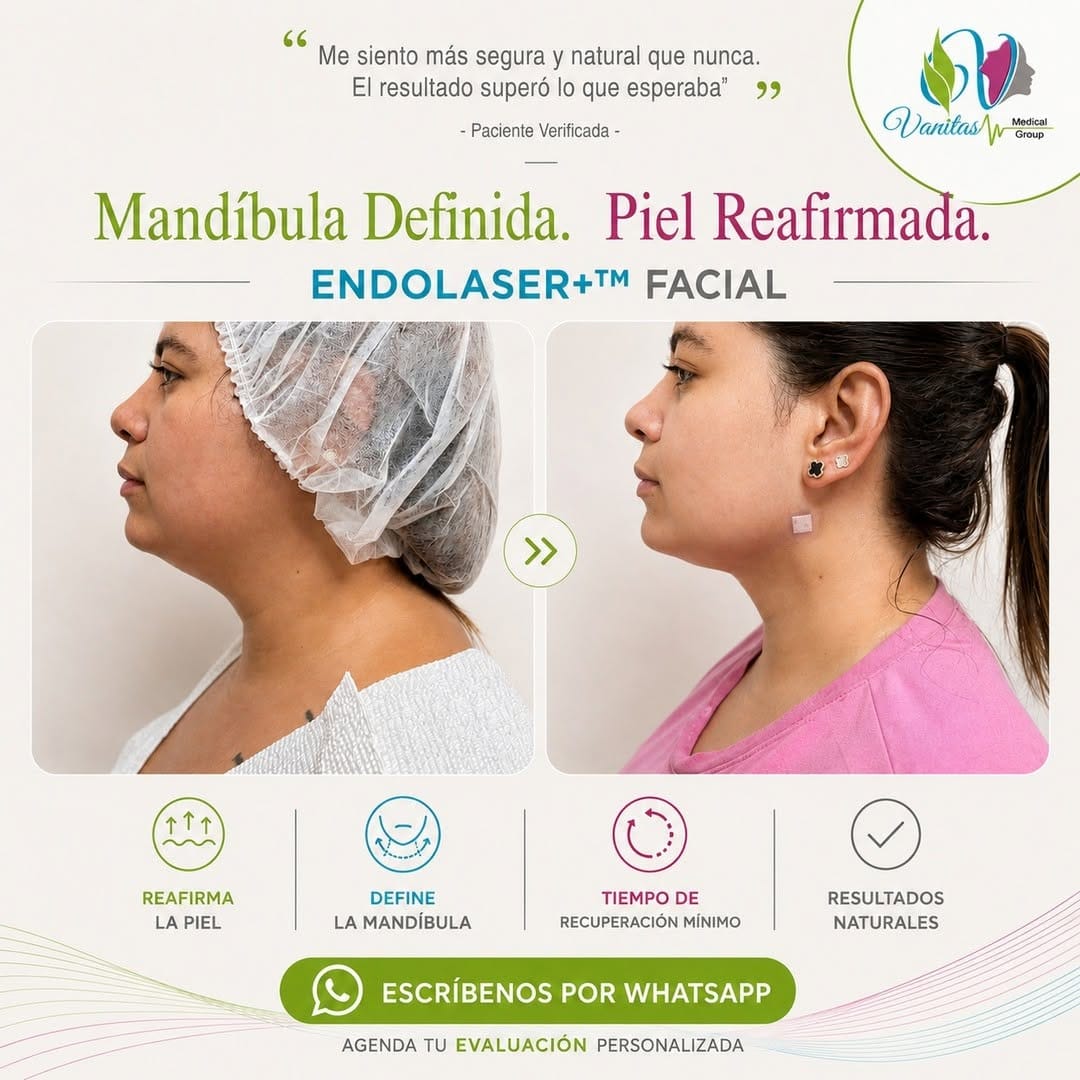 Post 4 by Vanitas | Cosmetic Surgery | Endaser + on Instagram (image)