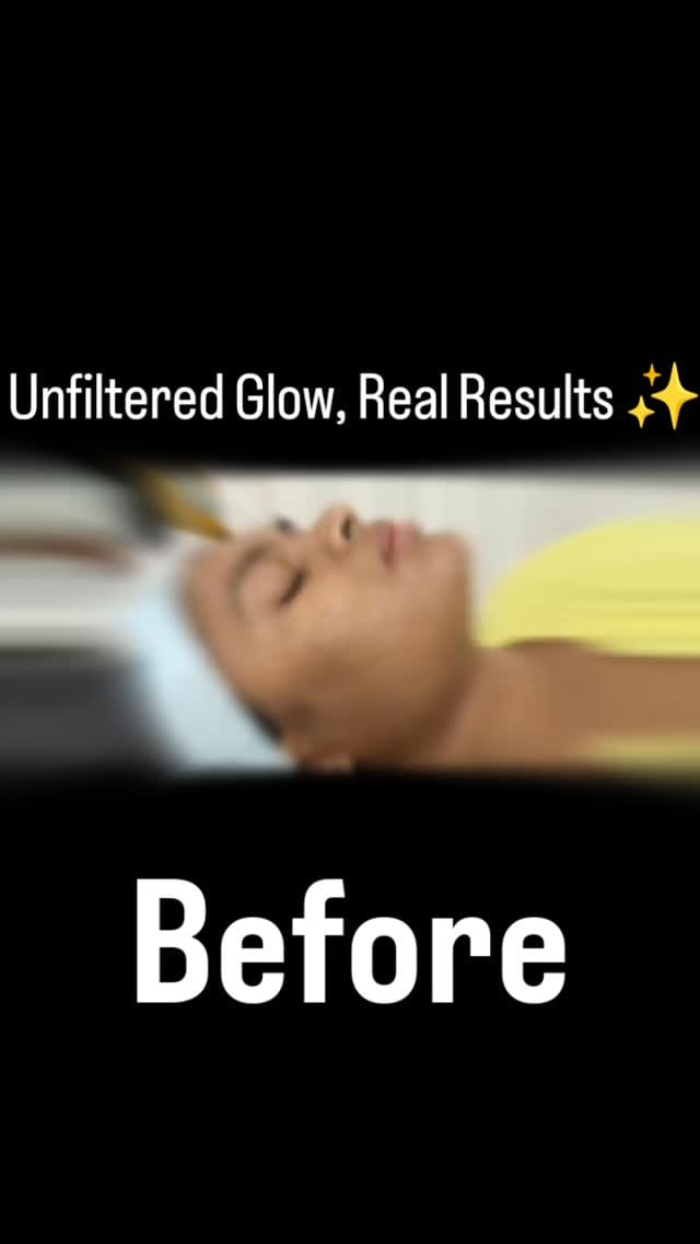 Post 3 by Dr Rudhee Sehgal | Cosmetic Surgeon on Instagram (video)