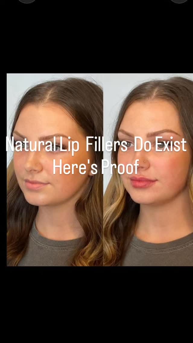 Post 2 by Dr Rudhee Sehgal | Cosmetic Surgeon on Instagram (video)