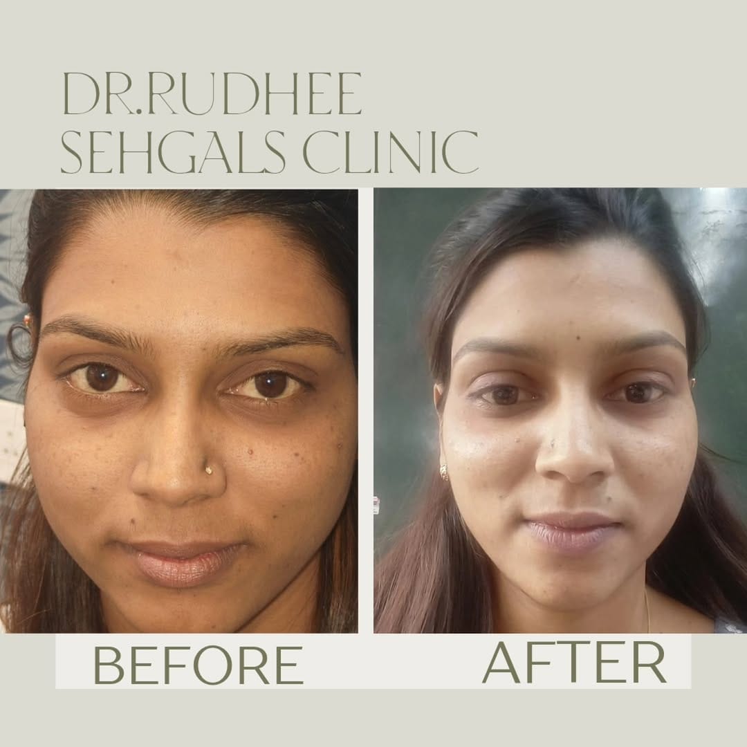Post 4 by Dr Rudhee Sehgal | Cosmetic Surgeon on Instagram (image)