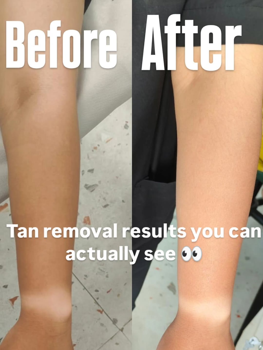 Post 5 by Dr Rudhee Sehgal | Cosmetic Surgeon on Instagram (image)