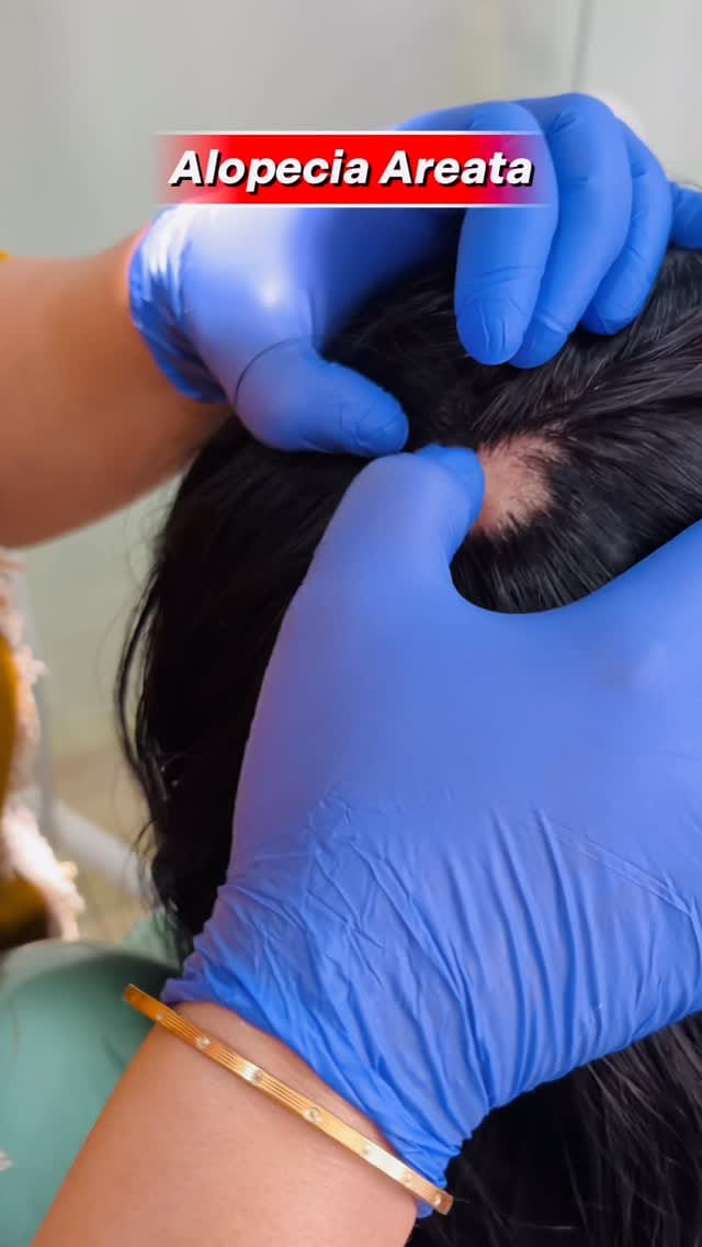 Post 1 by Dr. Shehnaj (Cosmo Clinic) on Instagram (video)