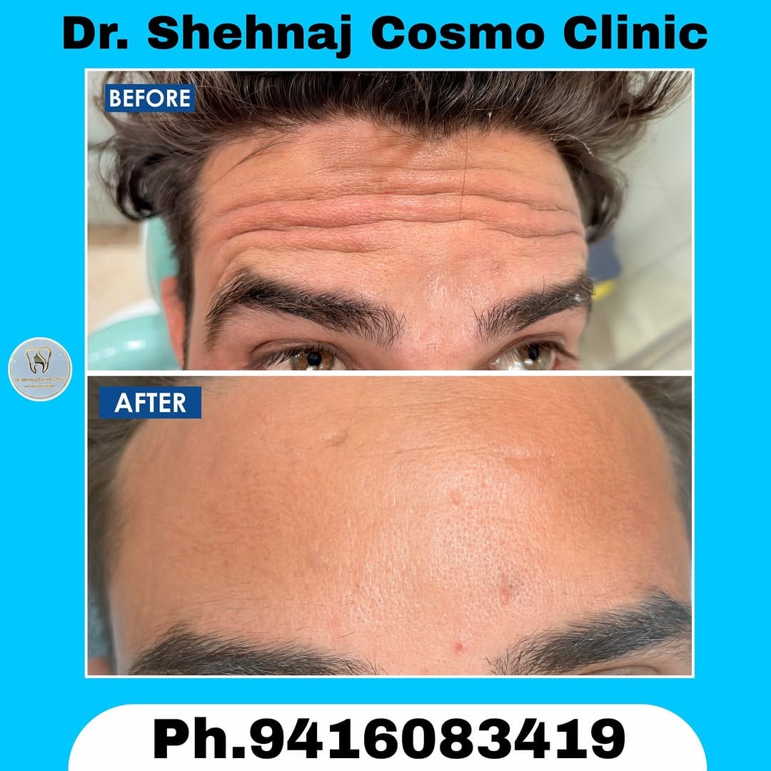 Post 3 by Dr. Shehnaj (Cosmo Clinic) on Instagram (image)
