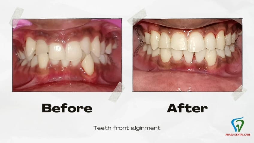Post 4 by Arasu Dental Care on Instagram (video)