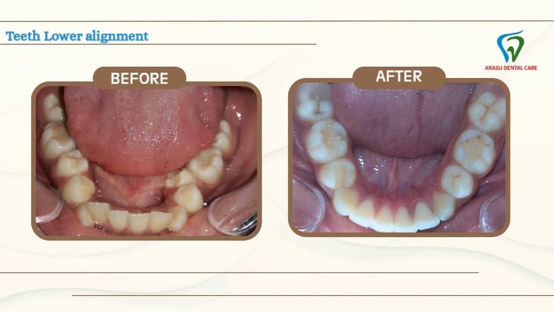 Post 6 by Arasu Dental Care on Instagram (video)