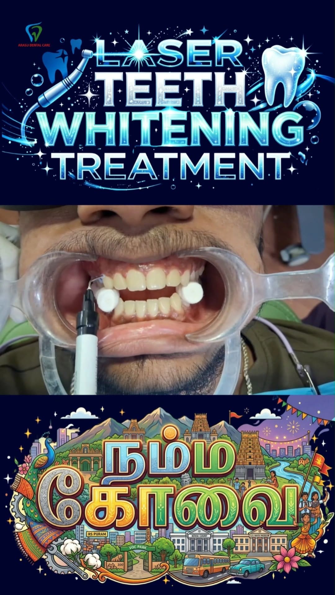 Post 2 by Arasu Dental Care on Instagram (video)