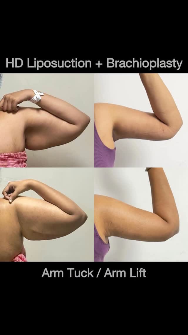 Post 9 by Rajasekhar Madala | The Celebrity Plastic Surgeon on Instagram (video)