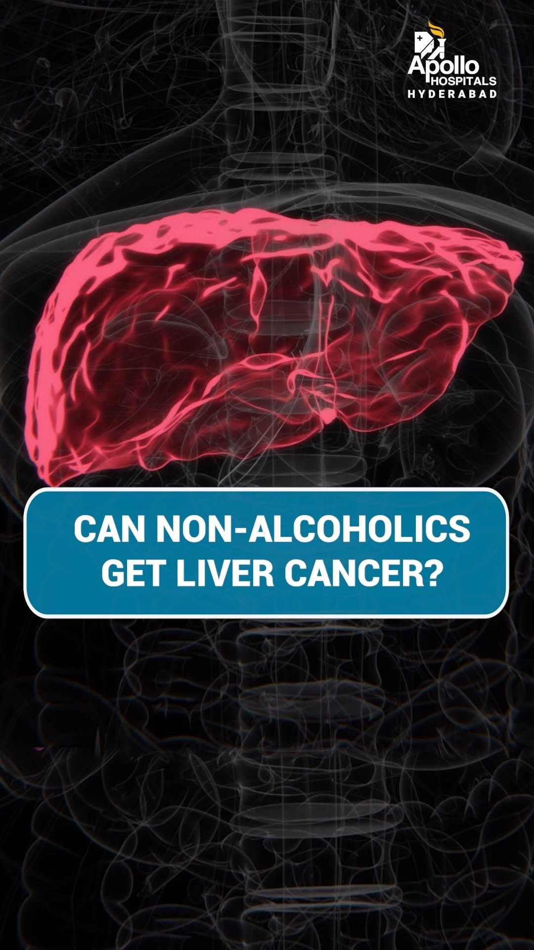 Post 4 by Apollo Hospitals Hyderabad on Instagram (video)