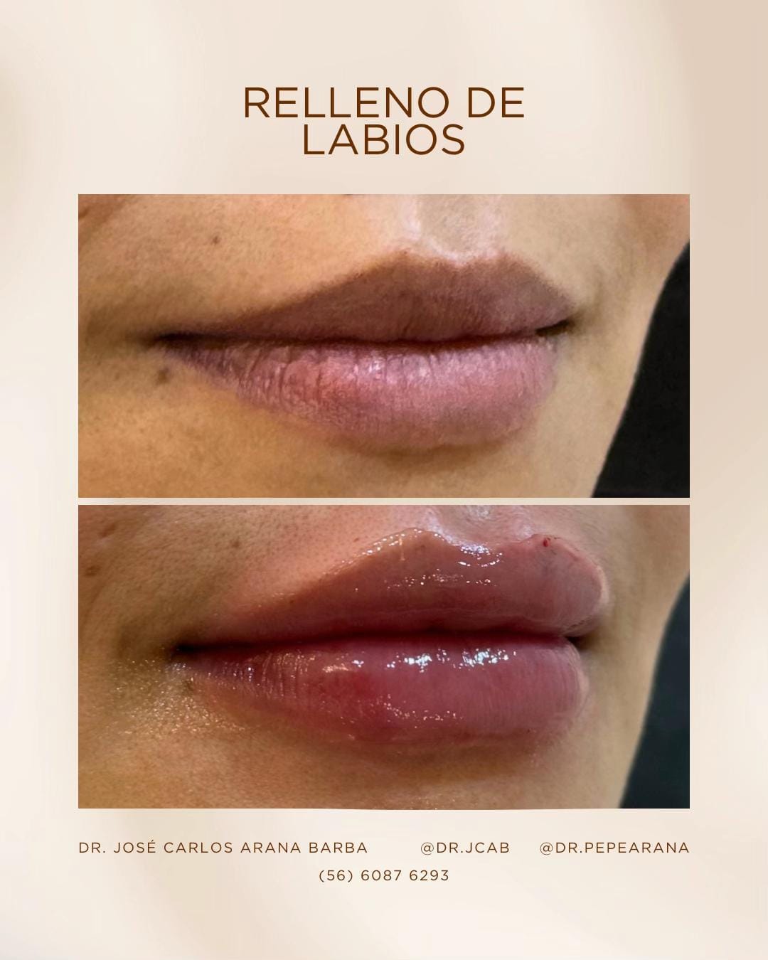 Post 7 by Dr. Pepe Arana on TikTok (video)