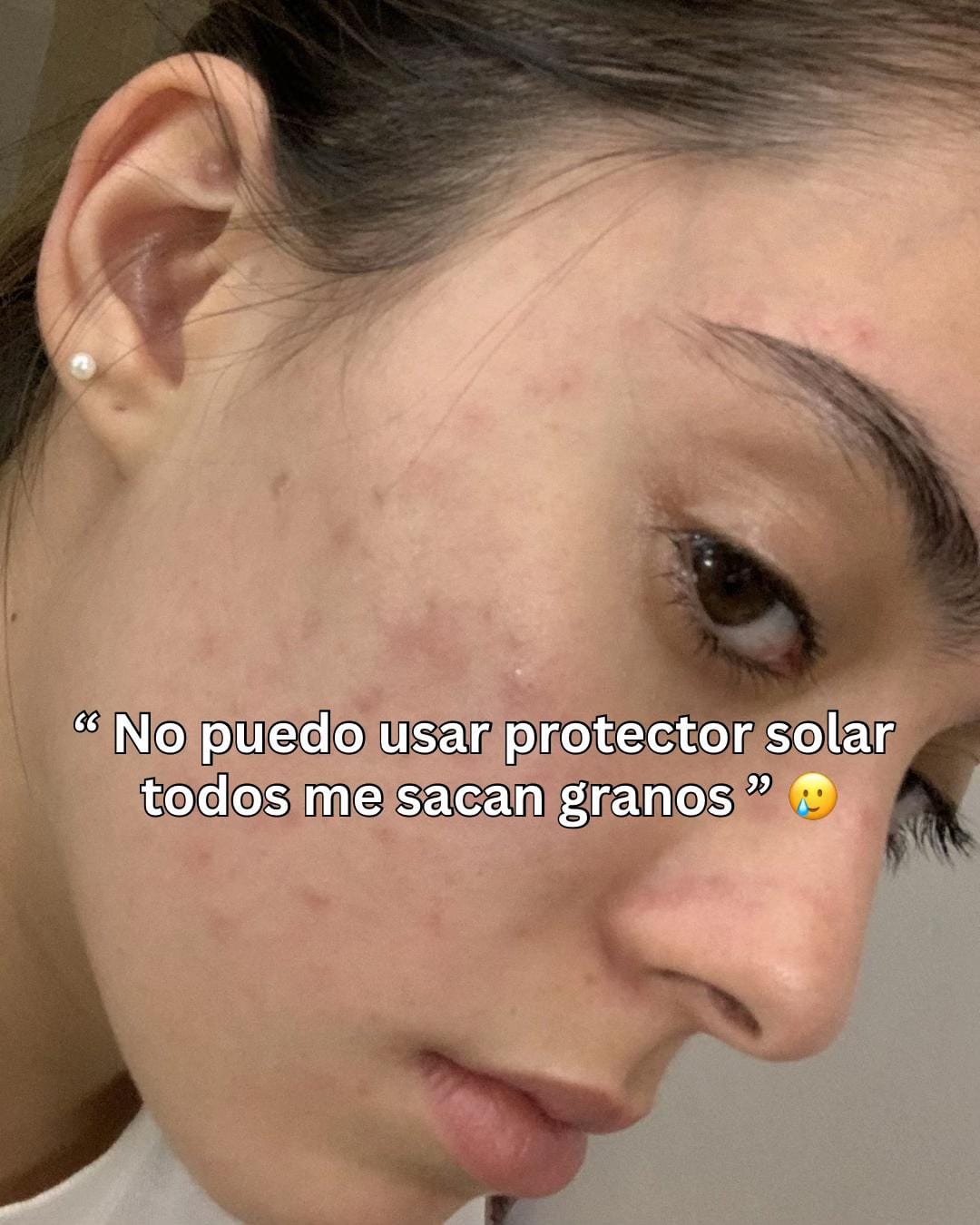 Post 7 by Skinco Beauty on TikTok (video)