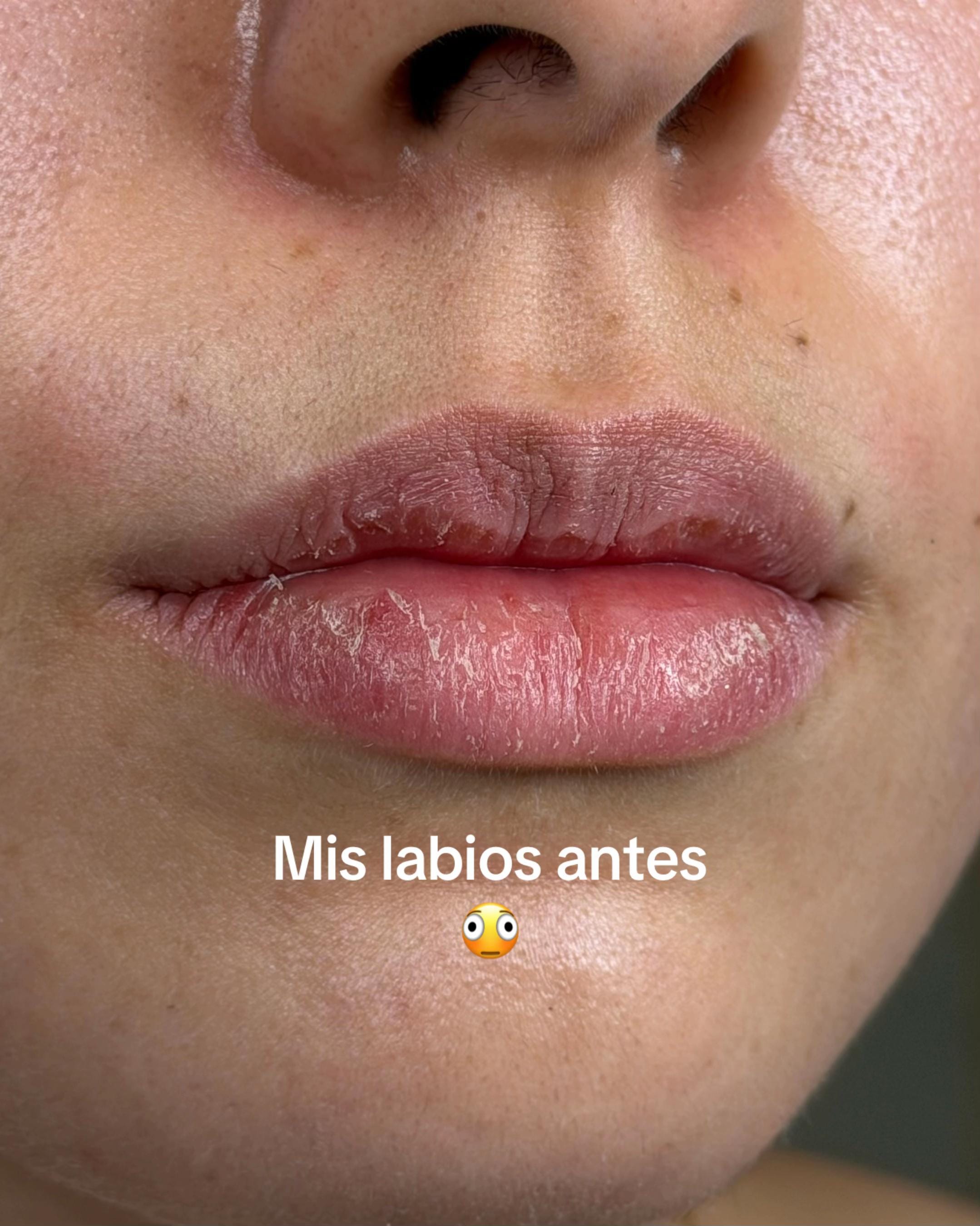 Post 5 by Skinco Beauty on TikTok (video)