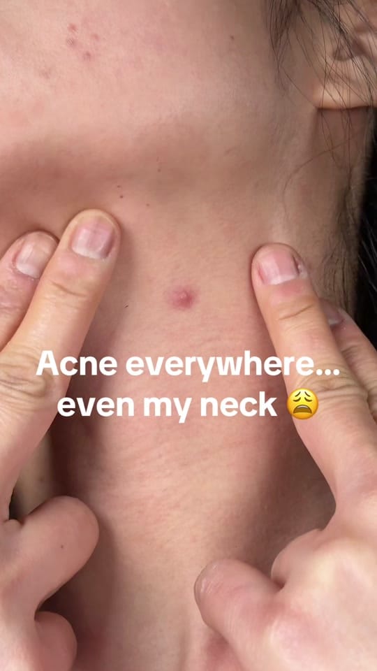 Post 9 by 🌸Ana.T🌸 on TikTok (video)