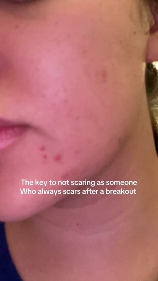 Post 7 by Jacquelyn on TikTok (video)