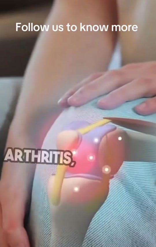 Post 4 by StemCellTherapy- MedLlataCare on TikTok (video)
