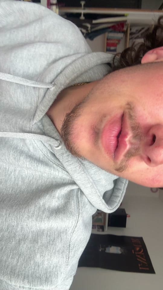 Post 1 by Axel on TikTok (video)