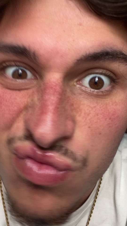 Post 10 by Axel on TikTok (video)