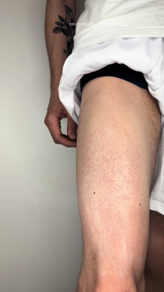 Post 1 by Piratetwanoo🇫🇷 on TikTok (video)