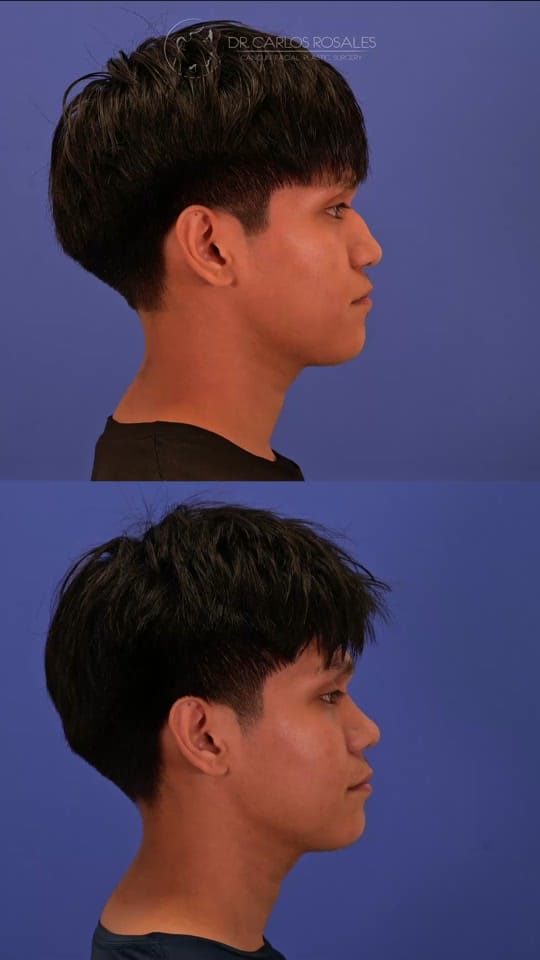 Post 10 by drcarlosrosales on TikTok (video)