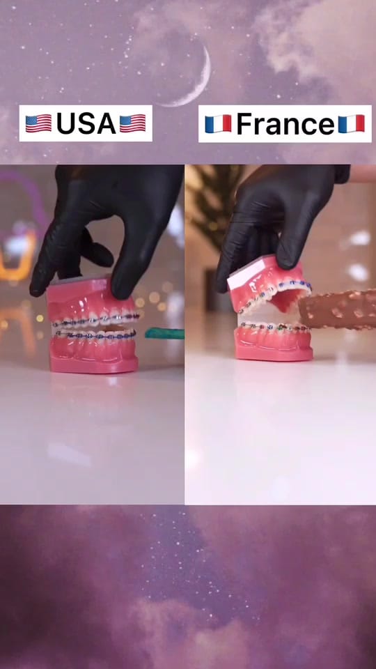 Post 10 by USA_vs_FRANCE on TikTok (video)