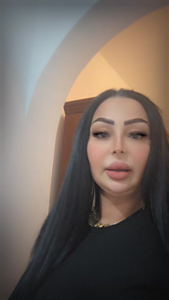Post 5 by Cheba Warda Charlomanti on TikTok (video)