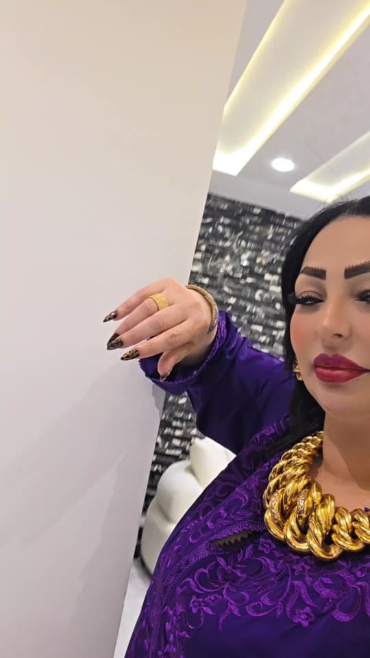 Post 8 by Cheba Warda Charlomanti on TikTok (video)