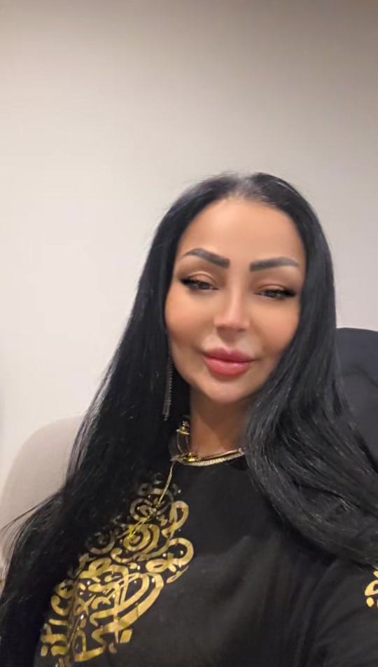 Post 1 by Cheba Warda Charlomanti on TikTok (video)