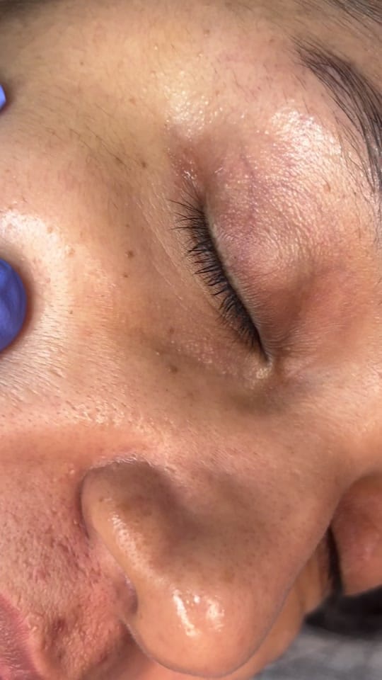 Post 9 by dra_ivonne_derma on TikTok (video)