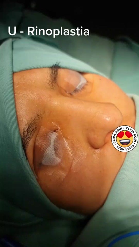 Post 4 by Dr. Marcelo Uriarte Mayorga on TikTok (video)