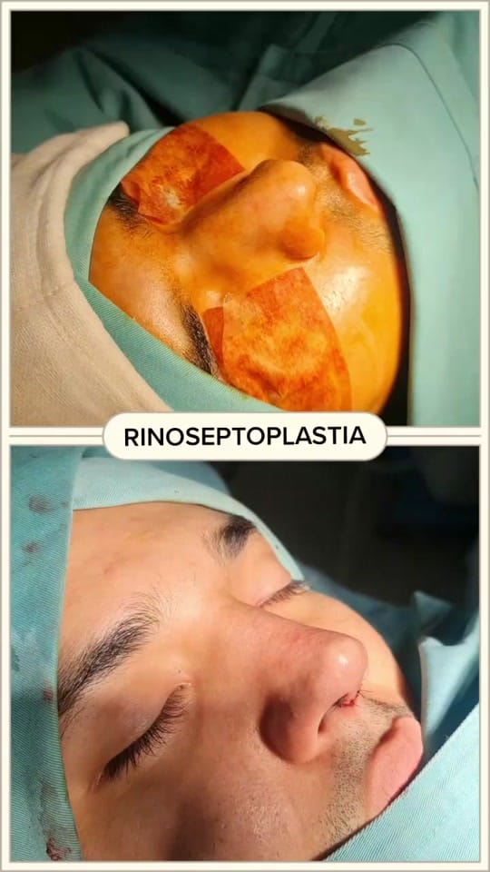 Post 7 by Dr. Marcelo Uriarte Mayorga on TikTok (video)