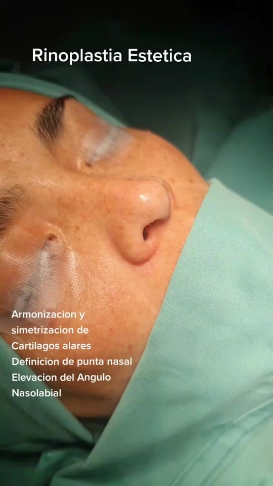 Post 5 by Dr. Marcelo Uriarte Mayorga on TikTok (video)