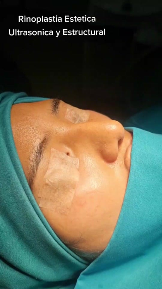 Post 6 by Dr. Marcelo Uriarte Mayorga on TikTok (video)
