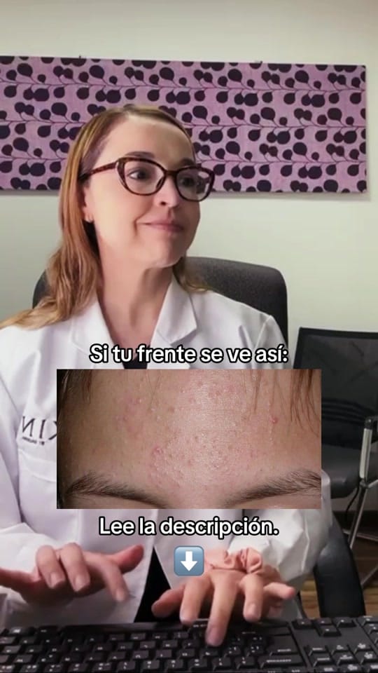 Post 4 by Dra. Nelly Espinoza MD FAAD on TikTok (video)