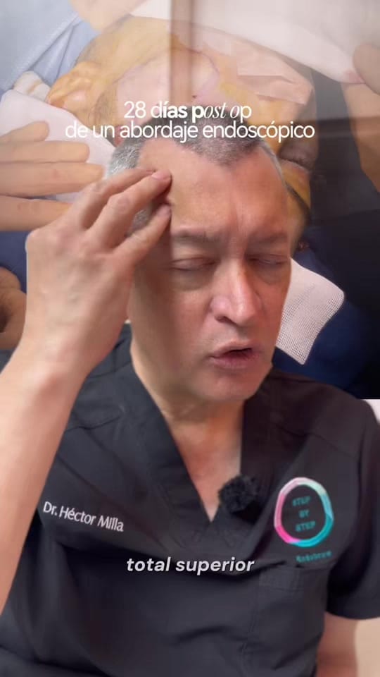Post 10 by Dr. Héctor Milla on TikTok (video)