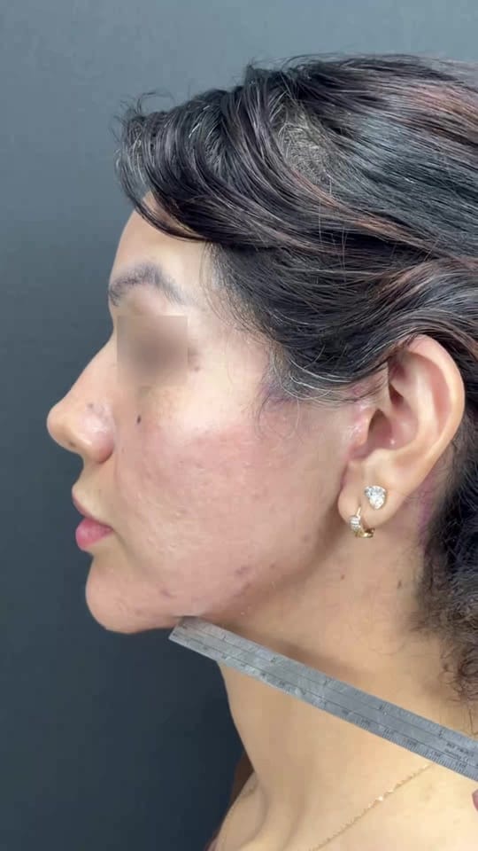 Post 9 by Dr. Héctor Milla on TikTok (video)