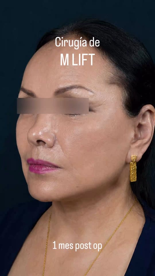 Post 4 by Dr. Héctor Milla on TikTok (video)