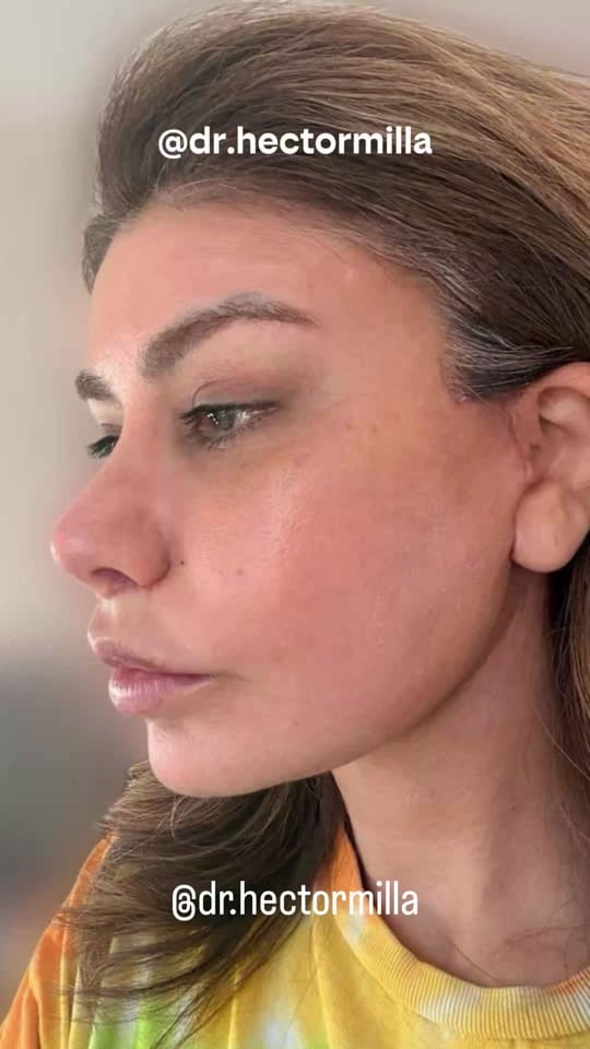Post 3 by Dr. Héctor Milla on TikTok (video)