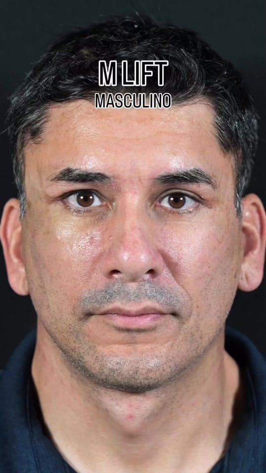 Post 2 by Dr. Héctor Milla on TikTok (video)