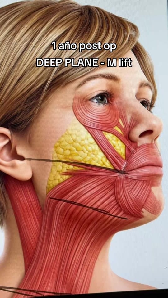 Post 5 by Dr. Héctor Milla on TikTok (video)