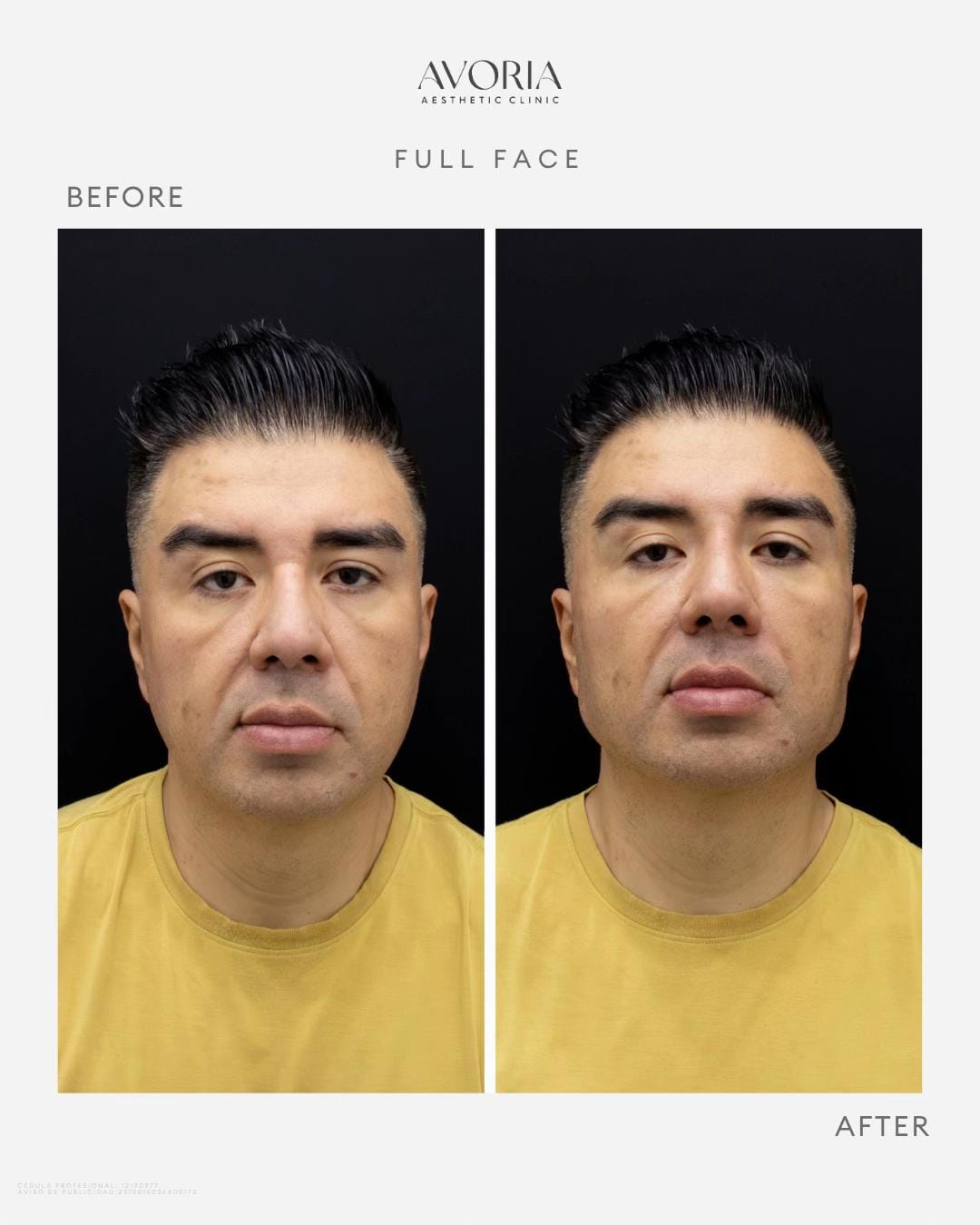 Post 6 by AVORIA AESTHETIC CLINIC on TikTok (video)