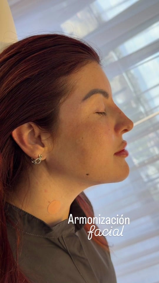 Post 4 by AVORIA AESTHETIC CLINIC on TikTok (video)
