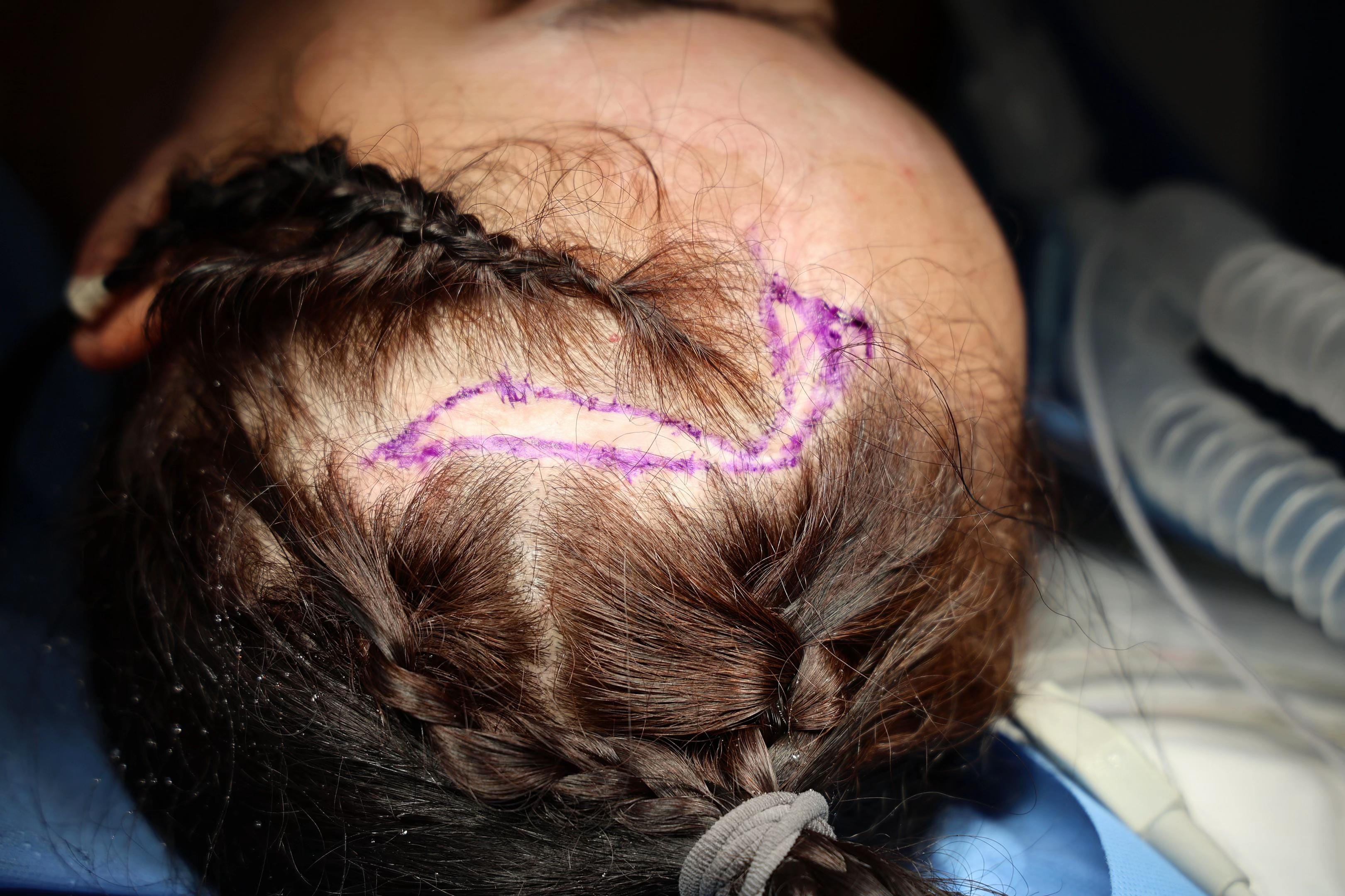 Post 3 by Dr. Hurtado Vidal on TikTok (video)