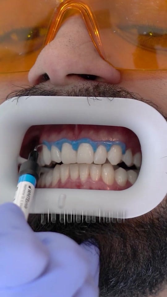 Post 4 by MKDental.mx on TikTok (video)
