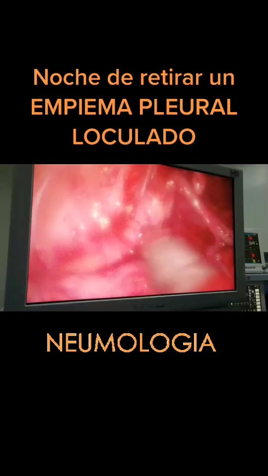 Post 10 by Dr. Iván Juárez Neumólogo on TikTok (video)