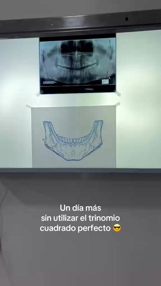 Post 2 by renerosalesmaxilofacial on TikTok (video)
