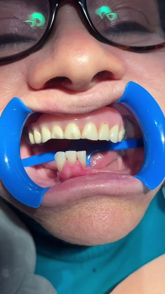 Post 6 by dentistamexicaliyahaira on TikTok (video)