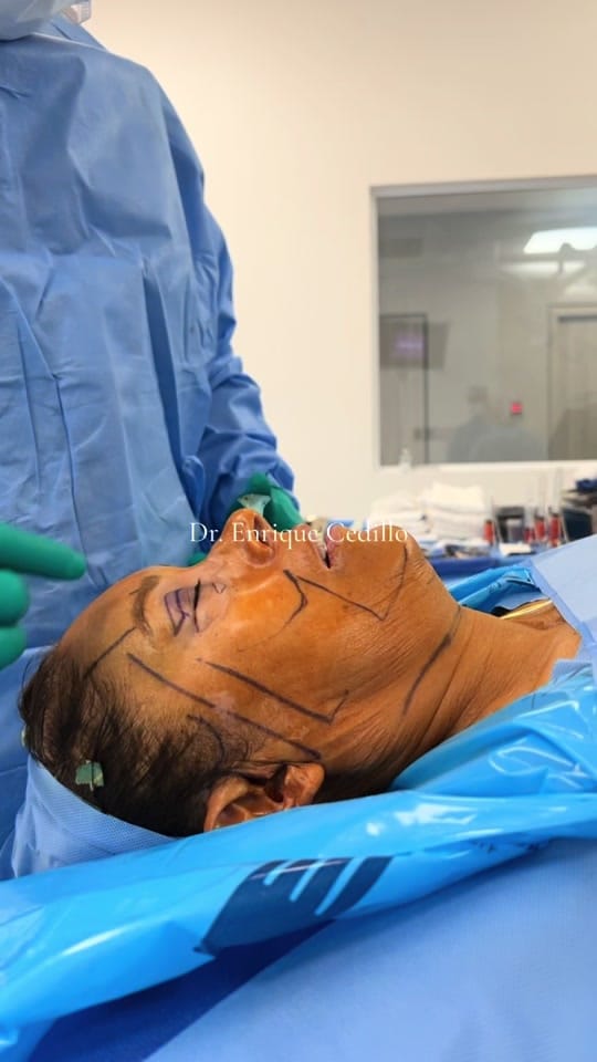 Post 10 by Dr. Enrique Cedillo on TikTok (video)