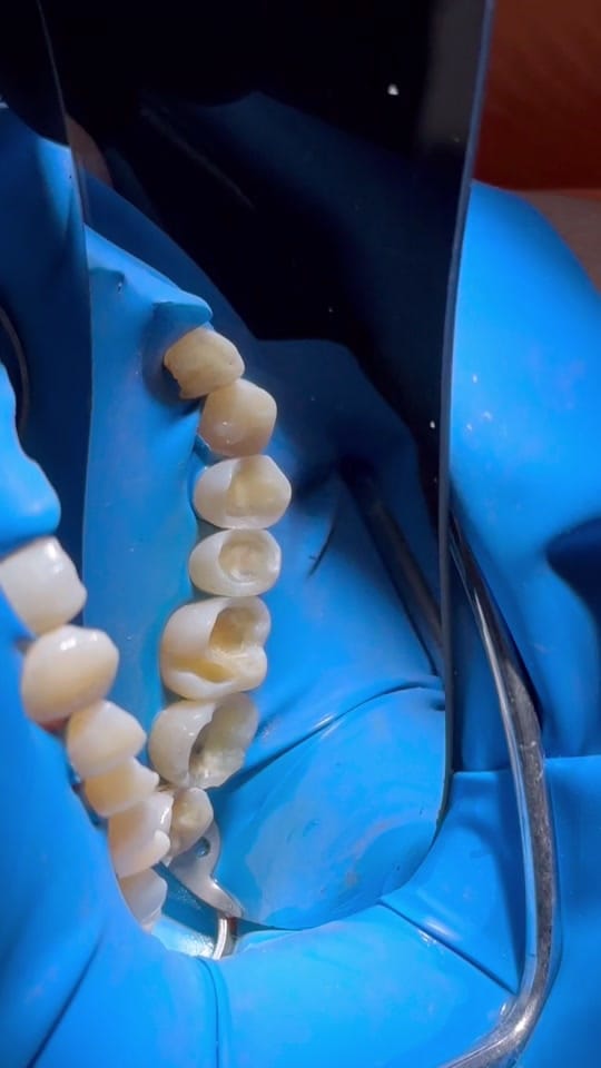 Post 10 by Dr. Roberto Alvidrez on TikTok (video)